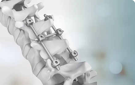 Performances et utilisations des matériaux en alliage de titane tels que les tiges médicales en titane.